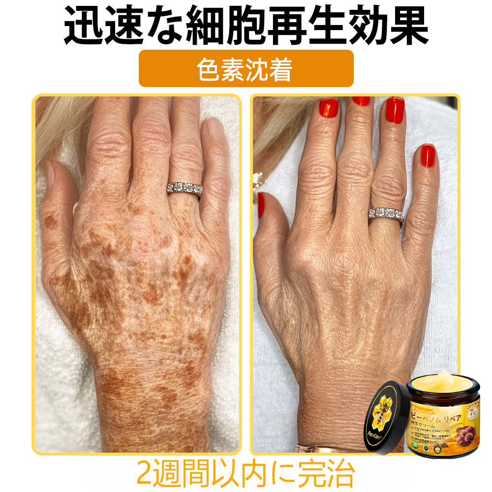 🧑‍⚕️🧑‍⚕️PuraCure® ビーベノム リペア再生クリーム🔥天然由来のエイジングケアで肌を引き締め、ハリを与え、乾燥による小ジワを目立たなくします – 50mL