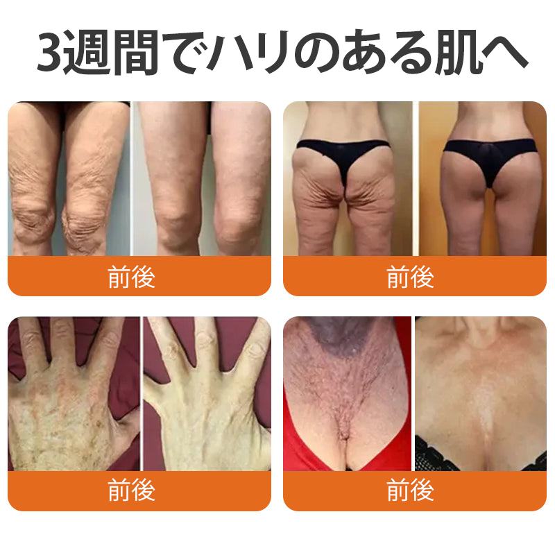 🧑‍⚕️🧑‍⚕️PuraCure® ビーベノム リペア再生クリーム🔥天然由来のエイジングケアで肌を引き締め、ハリを与え、乾燥による小ジワを目立たなくします – 50mL