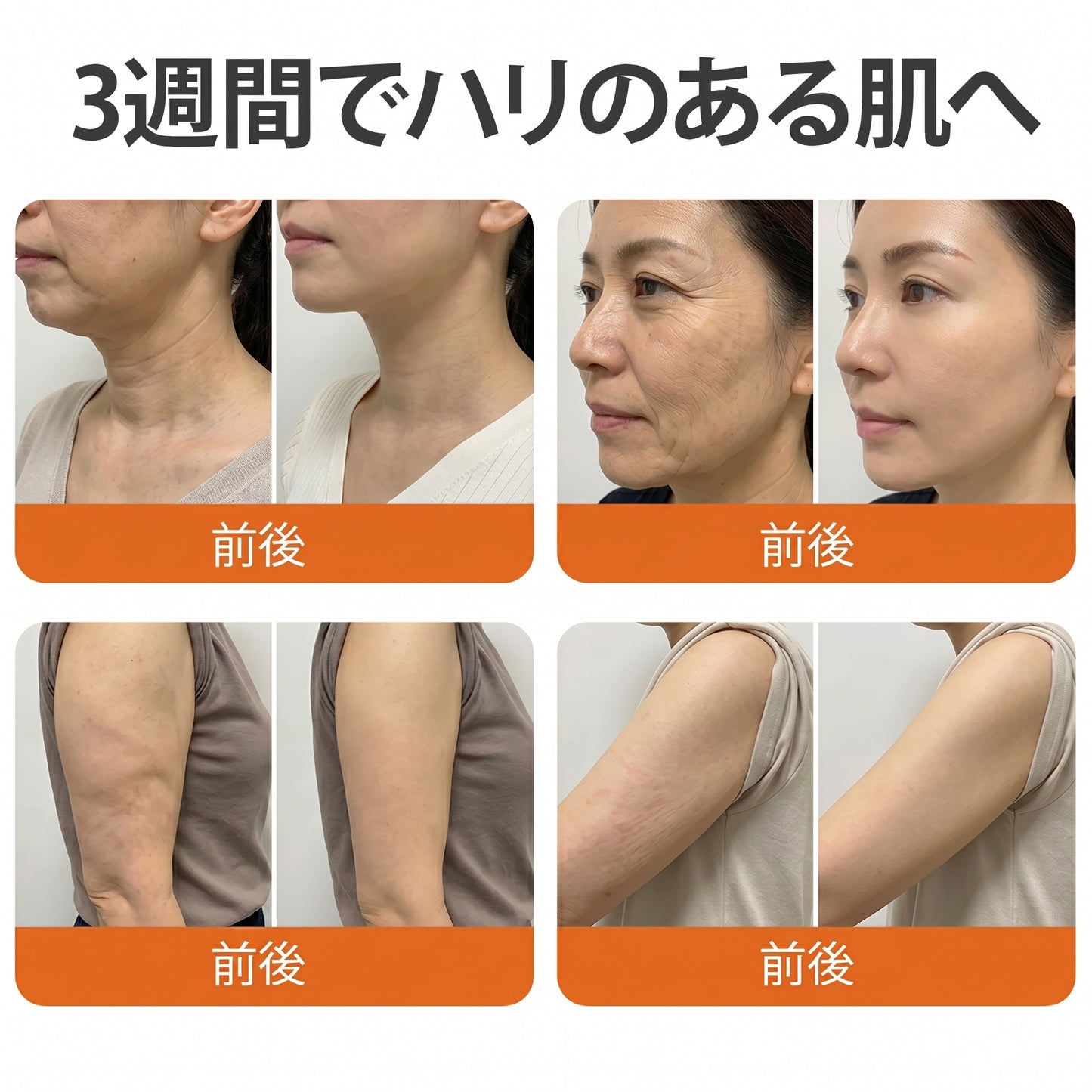 🧑‍⚕️🧑‍⚕️PuraCure® ビーベノム リペア再生クリーム🔥天然由来のエイジングケアで肌を引き締め、ハリを与え、乾燥による小ジワを目立たなくします – 50mL