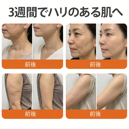 🧑‍⚕️🧑‍⚕️PuraCure® ビーベノム リペア再生クリーム🔥天然由来のエイジングケアで肌を引き締め、ハリを与え、乾燥による小ジワを目立たなくします – 50mL