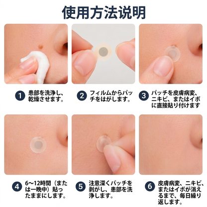 💙PuraCure® 2-in-1 マイクロニードル＆ハイドロコロイドパッチ🧑‍⚕️| 盛り上がったホクロ・ニキビ・扁平イボ・スキンタッグのケアに | シワ・ニキビ跡・肌の色ムラをケア | 目立たない透明パッチ（顔・体用）